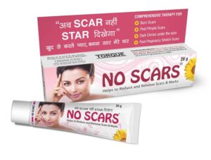acne scar removal